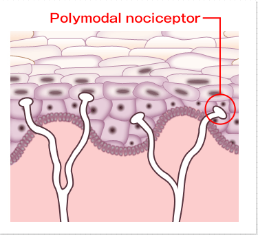 Polymodal nociceptor